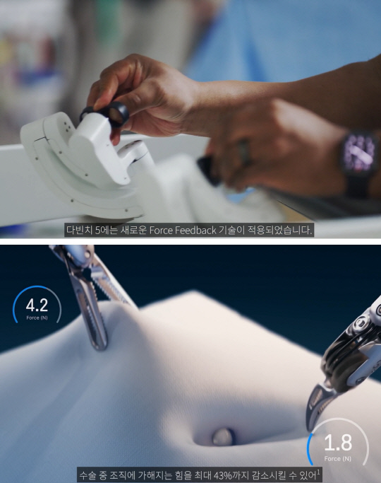 다빈치5 '포스 피드백' 기술. 인튜이티브 서지컬 제공.